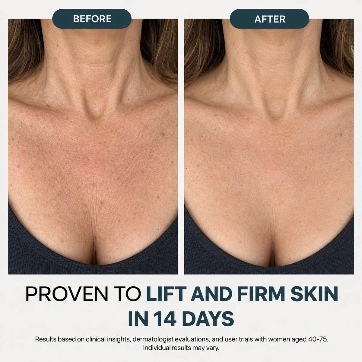 Before and after photo of the neck and chest