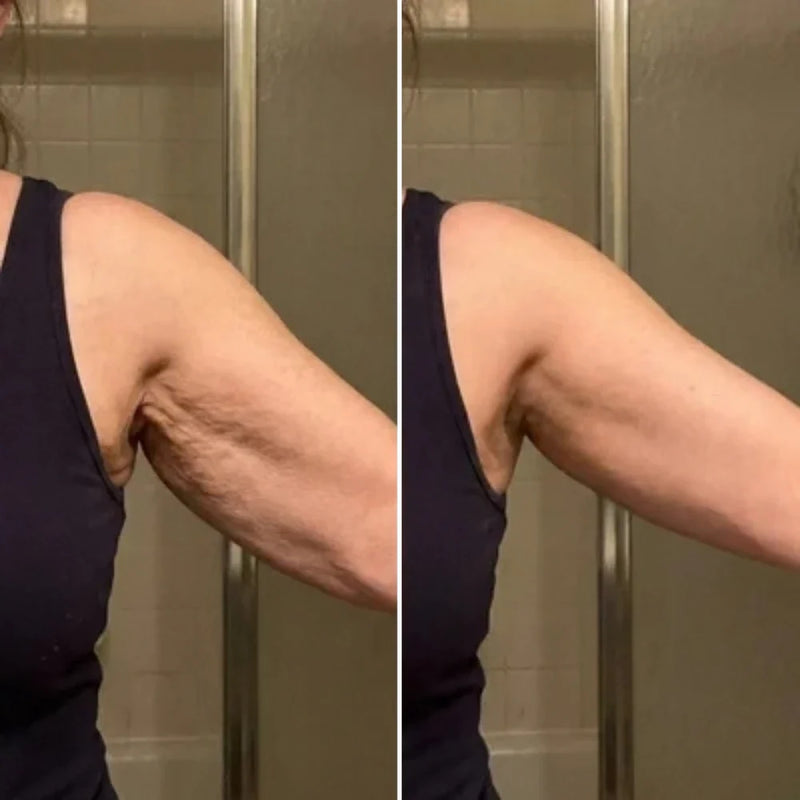 Anne, 61