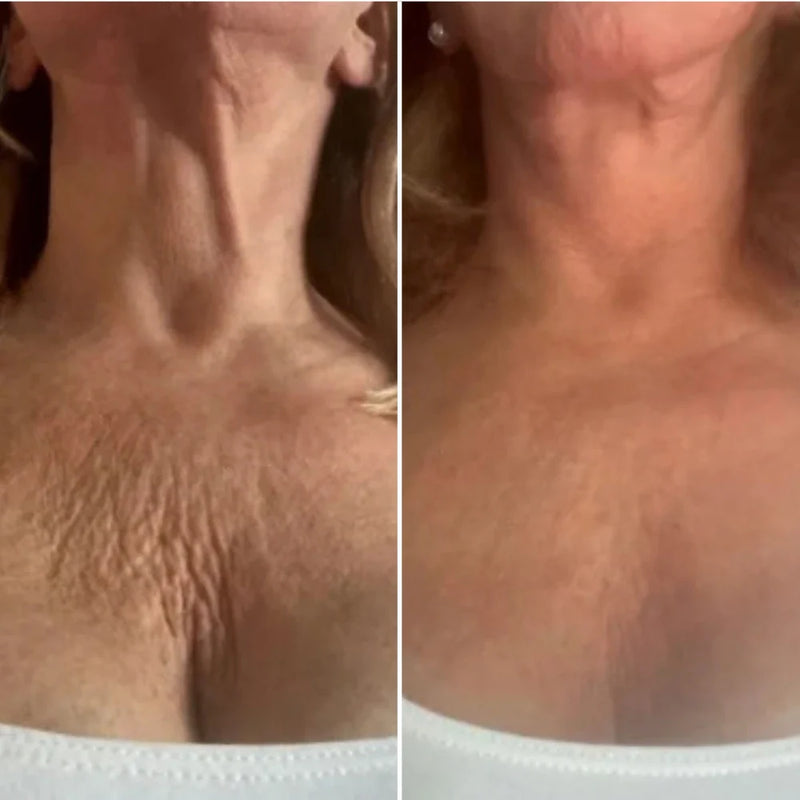 Diane, 63