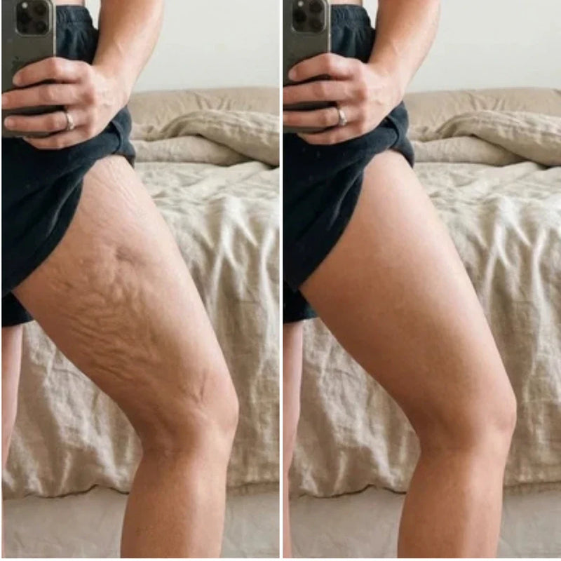 Michelle, 55