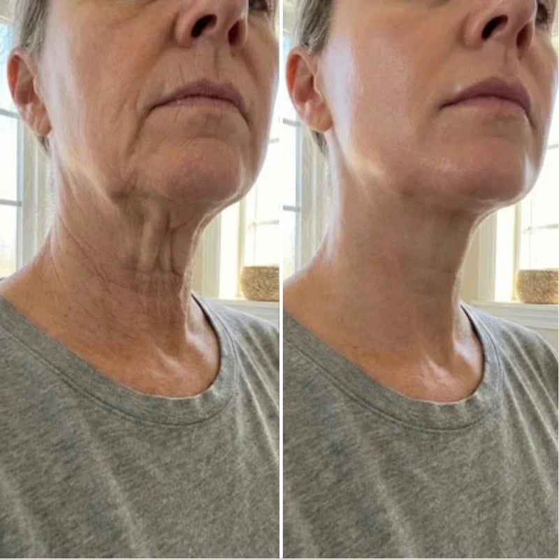 Patricia, 66